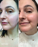 SKIN HERO - BAKUCHIOL SERUM 30ML 3SHIPS